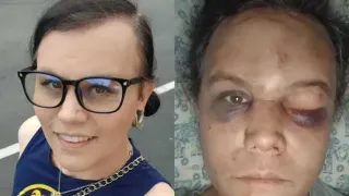 Trans Woman Attacked in Washington Cites Surge in Anti-Trans Hate, Links Rhetoric to Trump Administration